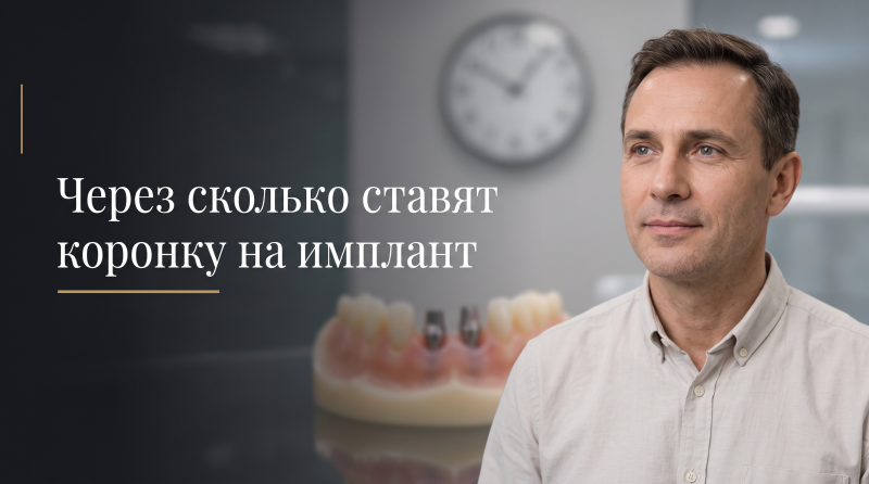 Через сколько ставят коронку на имплант