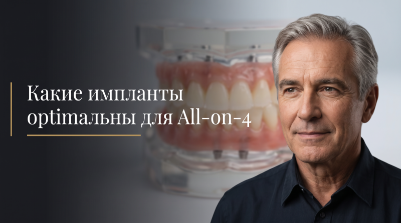 Какие импланты оптимальны для All-on-4