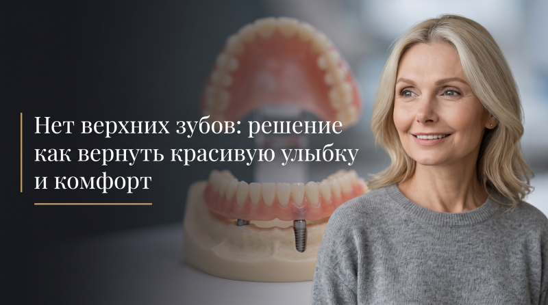 Нет верхних зубов: решение как вернуть красивую улыбку и комфорт
