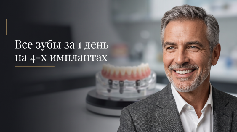 Все зубы за 1 день на 4-х имплантах