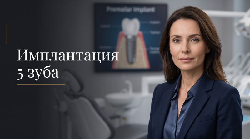 Имплантация 7 зуба