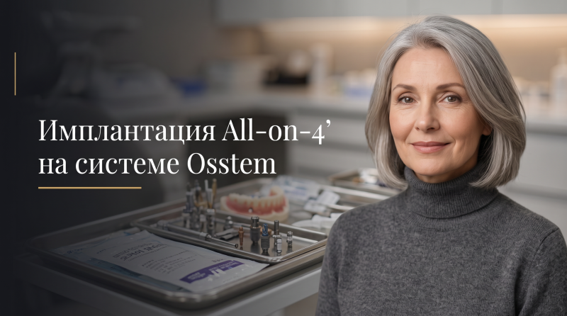 Имплантация All-on-4 на системе Osstem