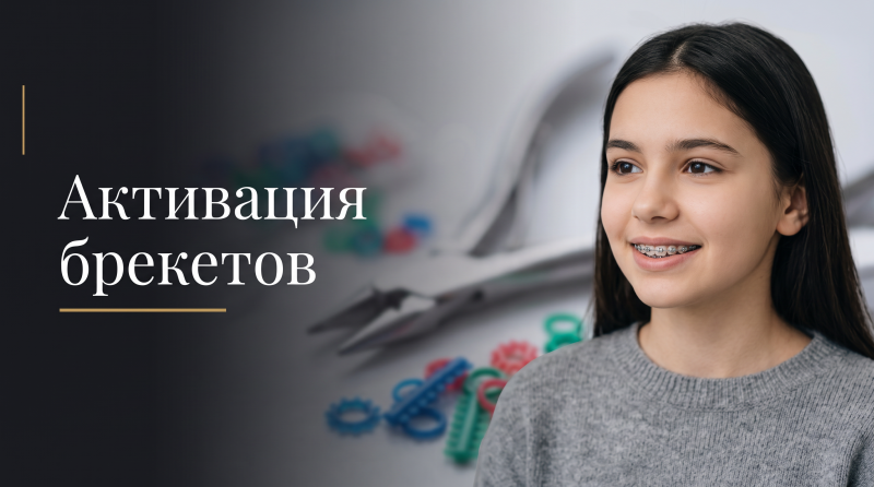 Активация брекетов