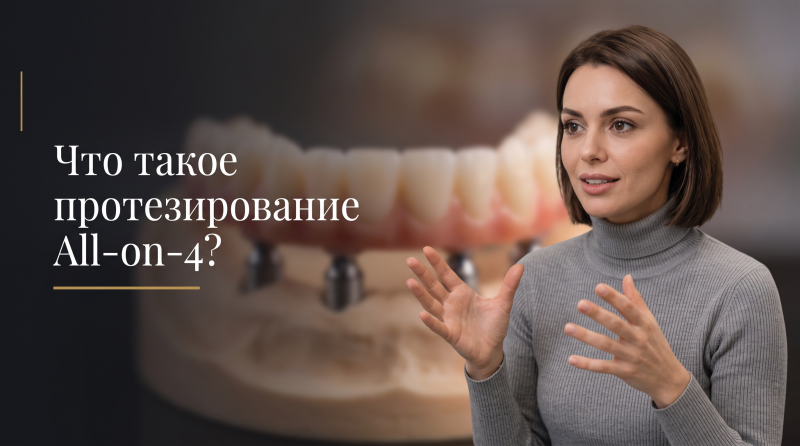 Что такое протезирование All-on-4?