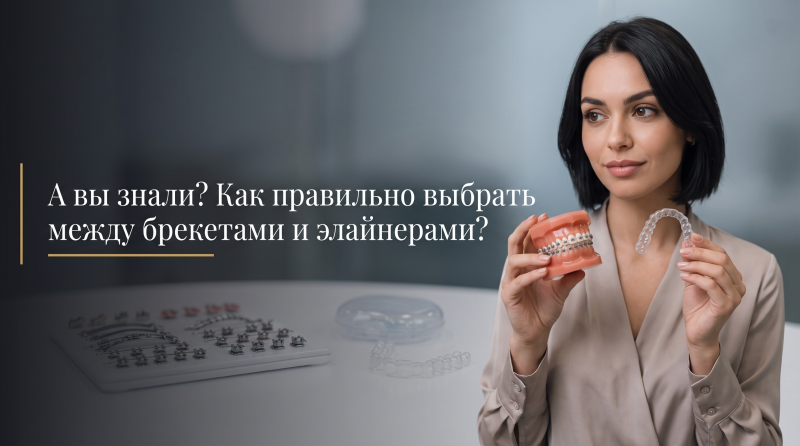 А вы знали? Как правильно выбрать между брекетами и элайнерами?