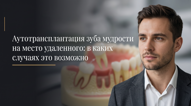 Аутотрансплантация зуба мудрости на место удаленного: в каких случаях это возможно
