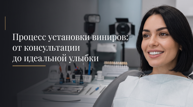 Процесс установки виниров: от консультации до идеальной улыбки
