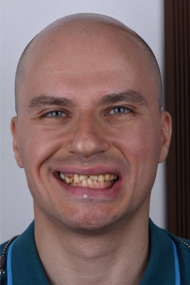 До