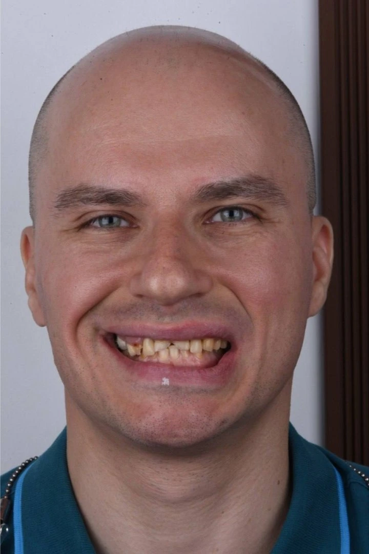 До